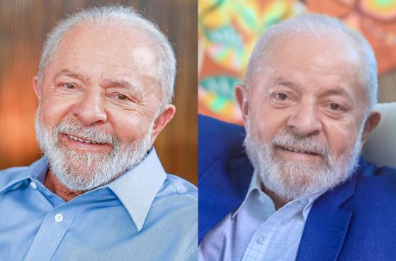 Compare fotos antes e depois de Lula pós-plástica nas pálpebras