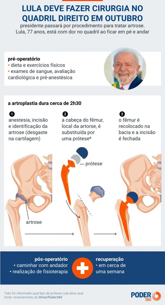 Lula reclama de dores e confirma cirurgia depois de viagens